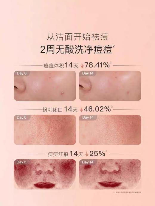 【春上新】9楼母婴生活馆 贝德美青少年洁面乳控油祛痘儿童洗面奶110mL 吊牌价：49.9元 活动价：39.9元 商品图2