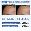 初尹8%壬二酸净颜精华20g 控油、祛痘、舒缓、敏感肌适用 商品缩略图1