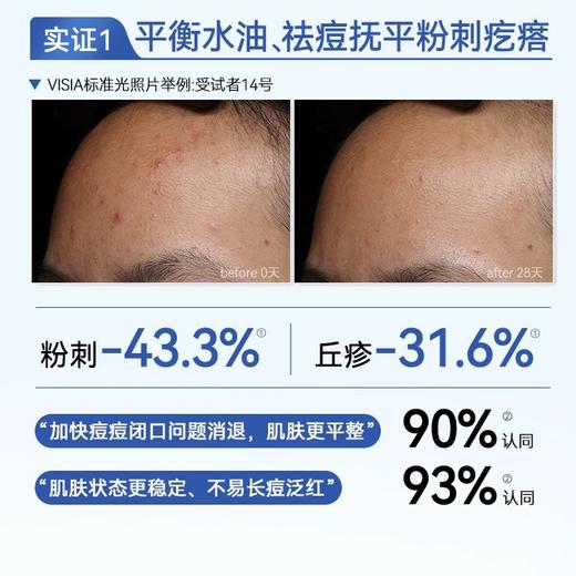 初尹8%壬二酸净颜精华20g 控油、祛痘、舒缓、敏感肌适用 商品图1