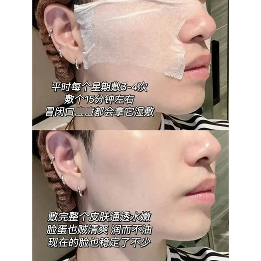 【补水收毛孔】科颜氏金盏花植物精华爽肤水75ml  油痘肌镇静消炎收缩毛孔 商品图5