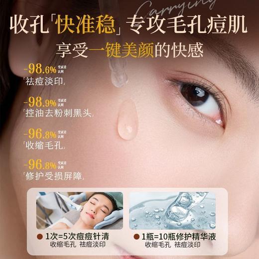 OHBT杏仁酸精华液收缩毛孔细腻肌肤舒缓修护补水保湿淡纹改善油痘 商品图2