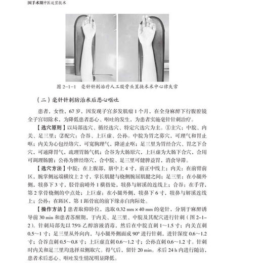 围手术期中医适宜技术 李天佐 苏帆 针法类中医适宜技术在围手术期的应用 理论与应用研究 9787830054984 中华医学电子音像出版社 商品图4