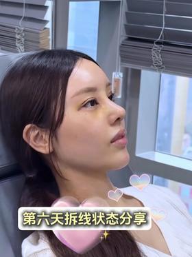 【种草佘高明】小美变顶美只差这一步