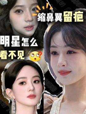 【种草佘高明】"无痕"是真技术还是滤镜❓