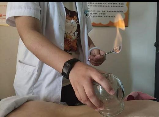 手功夫中医  拔罐/推拿/中药热敷/艾灸  【大金额代金券】 商品图3
