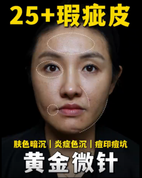 【种草朱虹】疲态脸热玛吉全脸发数分配！一篇讲清楚