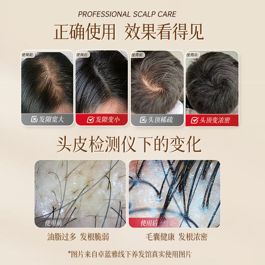 【3瓶装】卓蓝雅生姜防脱固发头皮精华液（生姜9号）ZT-1 商品图5