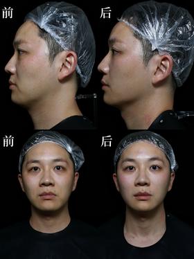 【种草朱虹】瑕疵皮有救啦！