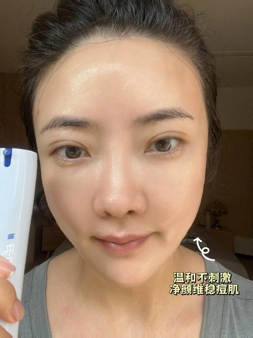 初尹8%壬二酸净颜精华20g 控油、祛痘、舒缓、敏感肌适用 商品图2