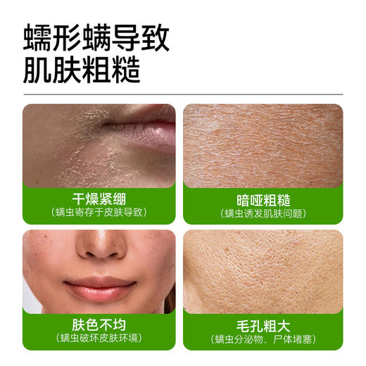 除螨细致焕颜皂108g——加入会员下单享8折，满69元送满婷清满保湿洁面乳，满119元送祛痘控油沐浴乳 商品图2