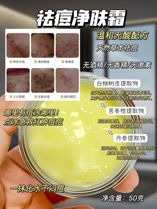 实验室高端定制 祛痘净肤霜50g  | 痘肌闭眼入！皮傲宁抗菌消炎 快速灭各种痘痘  痘印 商品图1