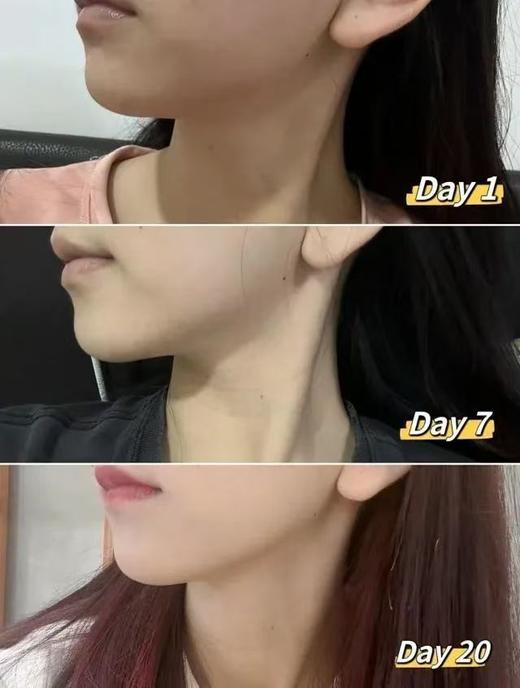 反重力V脸提拉面罩慕斯焕颜红绷带提拉紧致减双下巴面膜 商品图7