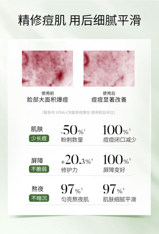 【痘敏肌祛痘必选】愈创木焕能修护祛痘修护精华 商品图9