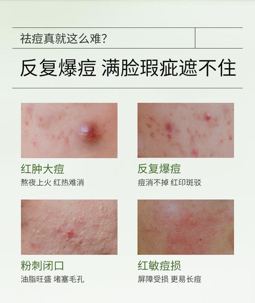 【痘敏肌祛痘必选】愈创木焕能修护祛痘修护精华 商品图7
