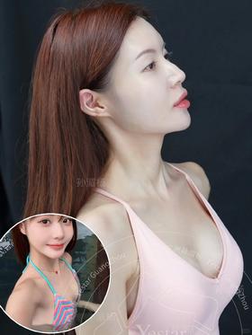 【孙湄杨】案例专区