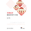 牙周松牙固定术操作详解 商品缩略图1