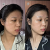 反重力V脸提拉面罩慕斯焕颜红绷带提拉紧致减双下巴面膜 商品缩略图5