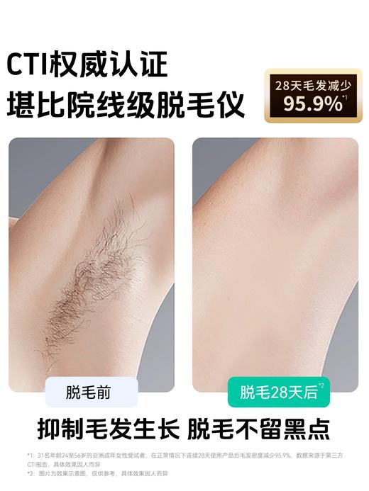 【新品首发】Luminera蓝宝石冰点脱毛仪学生党家用腋下腿毛唇毛 商品图2