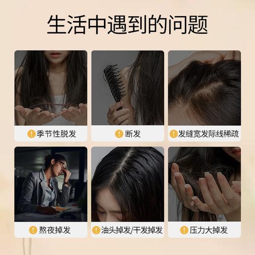 霸王育发防脱洗发液生姜防脱发去屑控油蓬松洗发露育发洗发液380ml效期29年4月（外包装日期轻微挤压变形） 商品图2