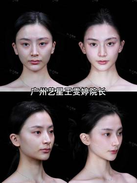 微调从来不是一个模板千人一面，而是找到每个人的风格，千人千面，美得个性