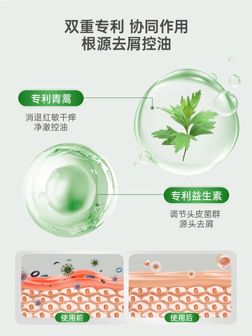 ⁵清69元2瓶【米亚可青蒿头皮素】头皮素同厂容量大一倍，头皮长痘 头皮屑 150ml/支  YY05-QTT-YLJZ 商品图8