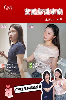 【艺星孙湄杨】好评案例-主持人小雨