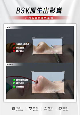 鼻子是面部的C位