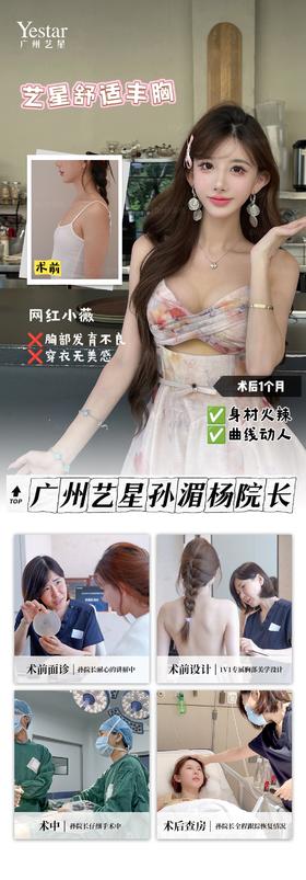 【艺星孙湄杨】网红小薇术后1个月好评