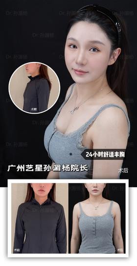 【艺星孙湄杨】24小时舒适丰胸