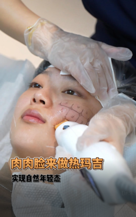 担心肉肉脸做热玛吉没效果❓