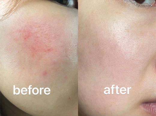 把半瓶精华倒进面膜里！CSS希妍萃色修精华面膜5片/盒 商品图5