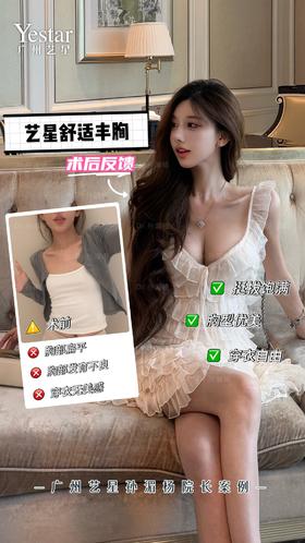 【艺星孙湄杨】术后反馈