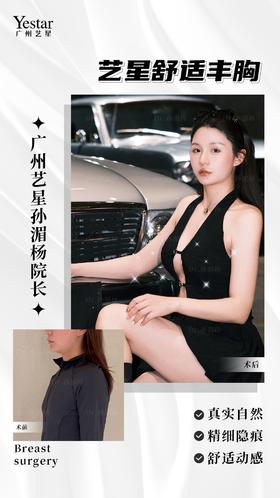 【艺星孙湄杨】术前术后对比