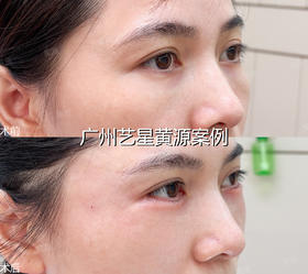 👀【赋活眼周，点亮魅力】👀