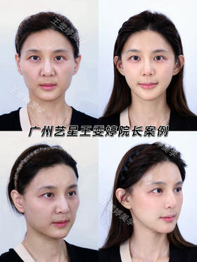 从那个阿姨变回小姐姐‼️