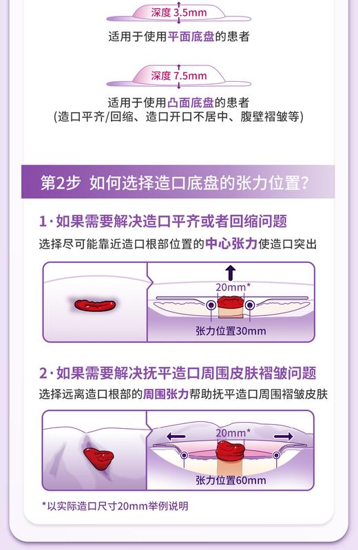 CONVATEC康维德Esteem Body爱顺宜一件式软凸开口大便造口袋423666 商品图5