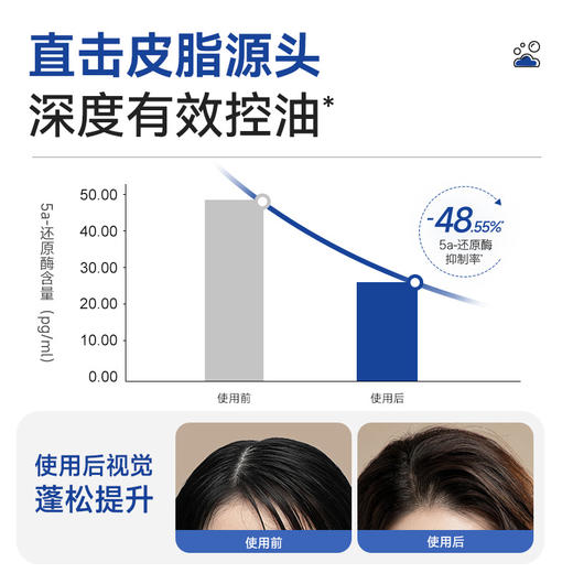 满婷海盐去屑控油蓬松洗发水500ml*3【专享】——不参与满减/赠 商品图4