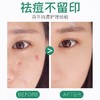 曼秀雷敦乐肤洁隐形净痘贴片26片 商品缩略图4