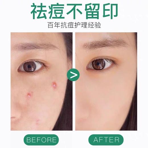 曼秀雷敦乐肤洁隐形净痘贴片26片 商品图4