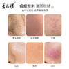 【新升级一支多效】季德胜老国货洁面乳舒缓去角质 粉刺 黑头深层清洁毛孔洗面奶 商品缩略图4