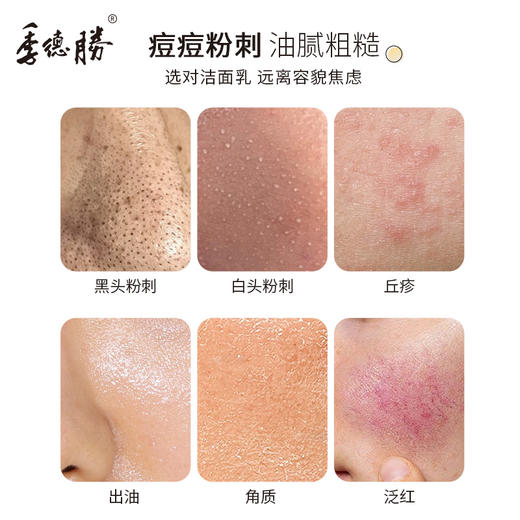 【新升级一支多效】季德胜老国货洁面乳舒缓去角质 粉刺 黑头深层清洁毛孔洗面奶 商品图4