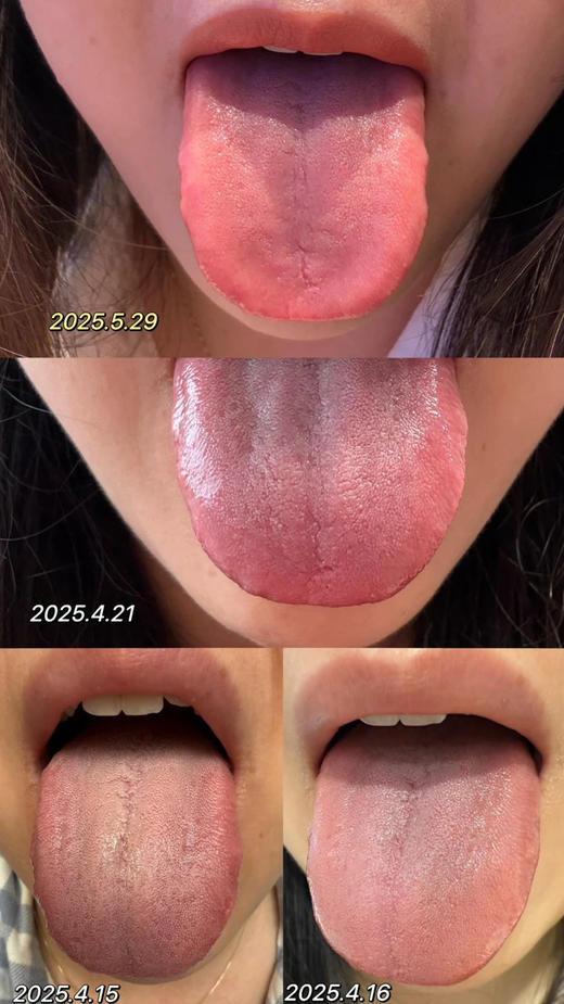 【预售】养心脾，养“后天之本”，中yi药方钛分子！坎离和合丹人参黄精多肽丸，千年古方传承，心脾同调 24克/瓶 每瓶均120粒 (赠品效期剩余6个月) 商品图10