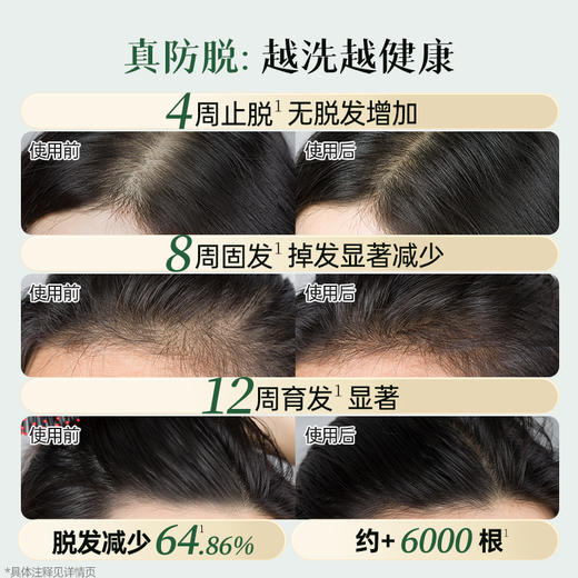 荷馨防脱育发洗发露150ml 商品图3