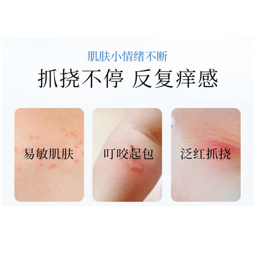 【买一送一 自研新品】兰渚堂舒肤保健膏 虫毒膏 商品图1