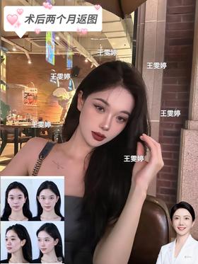 术后两个月返图【王雯婷院长】