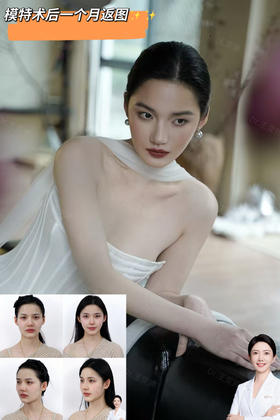 【王雯婷】模特术后一个月返图
