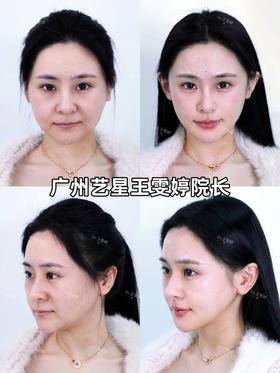 【王雯婷院长】美丽十点睡