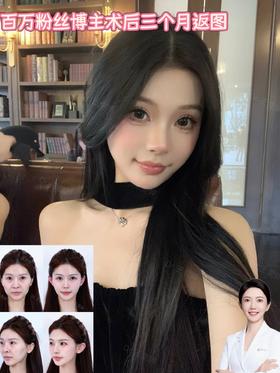 【王雯婷院长】百万粉丝博主术后三个月返图