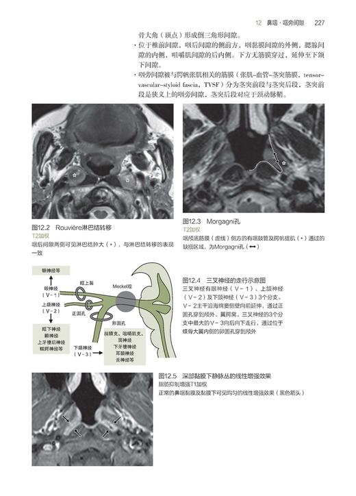 头颈部影像诊断技巧图解 商品图5
