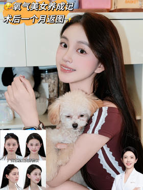 氧气美女养成记，术后一个月返图【王雯婷院长】